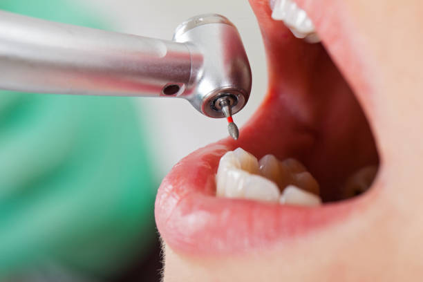 Best Same-Day Emergency Dentist in Lake Don Pedro, CA